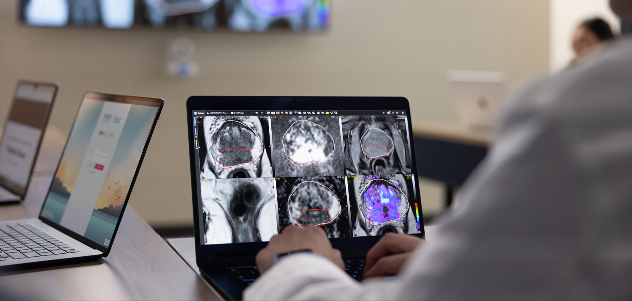 Una persona esamina scansioni mediche su un MacBook, con altri due MacBook aperti sullo sfondo.