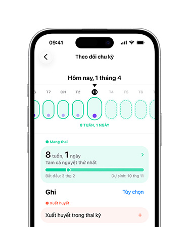 iPhone, tính năng Theo Dõi Chu Kỳ trong ứng dụng Sức Khỏe được thiết lập để theo dõi các mốc phát triển trong thai kỳ
